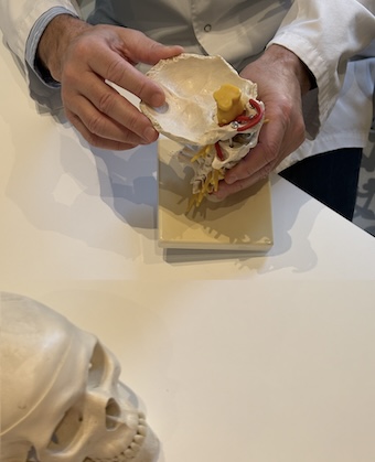 malformacion de chiari I